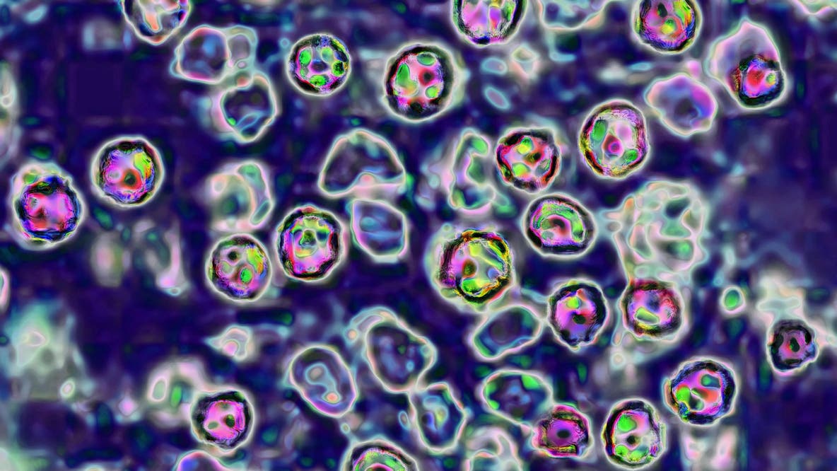Measles Alert: Infected tourist exposes Chase Field, Chandler Fashion Center, 4 other Valley spots