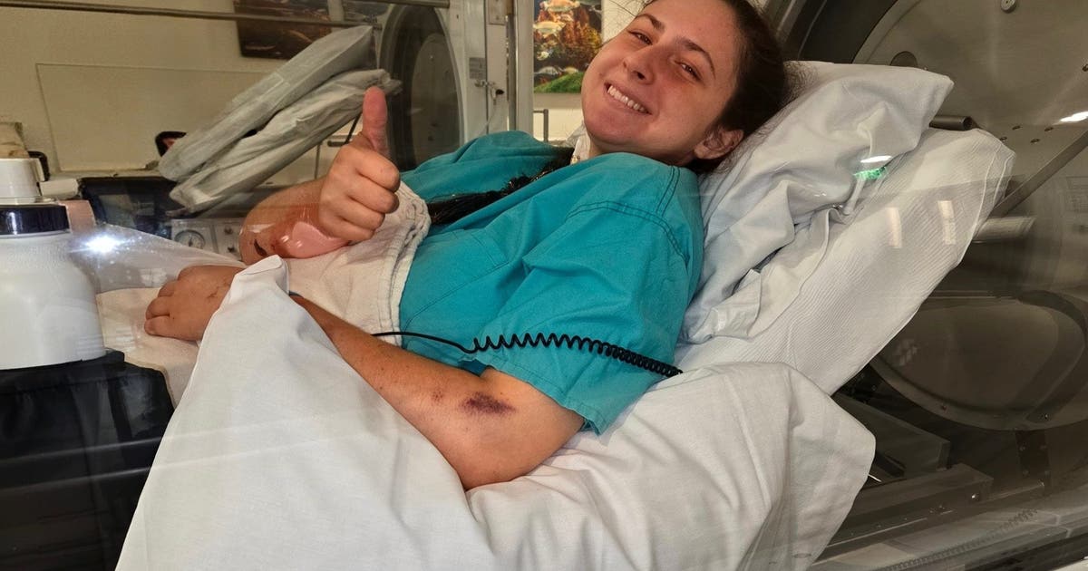 20-year-old hiker warns others after heat stroke at Grand Canyon