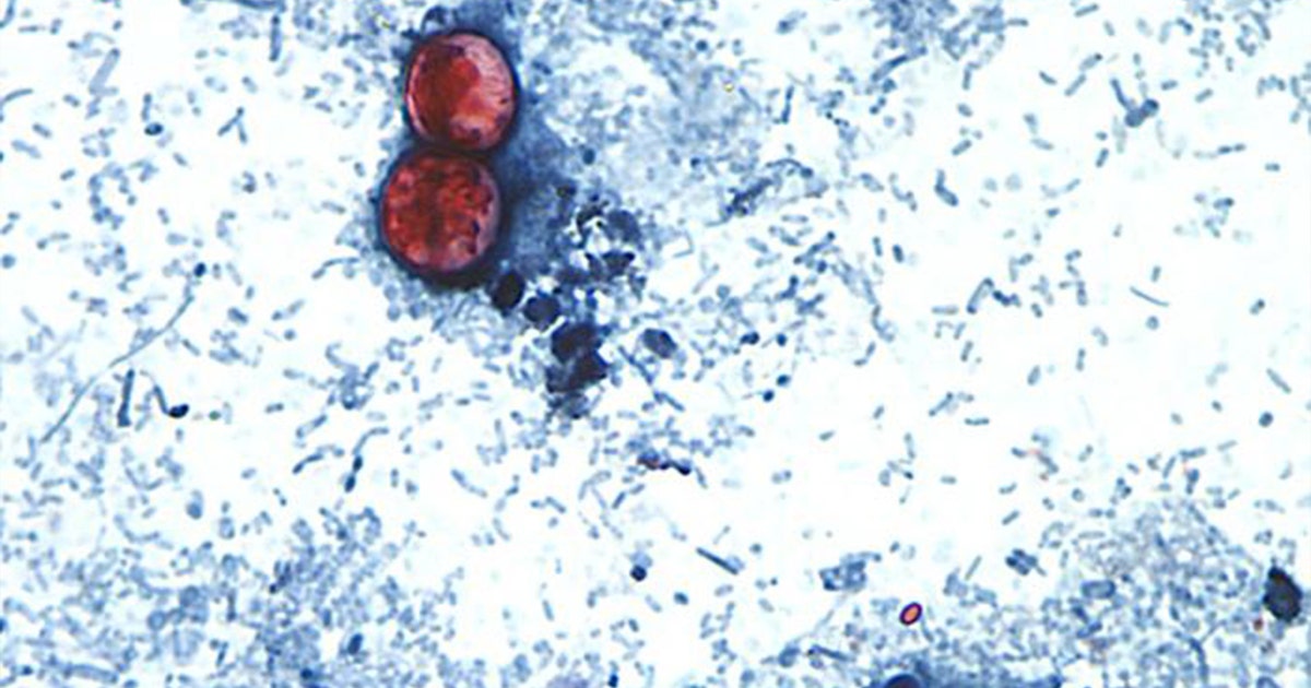 Cyclosporiasis: Some Arizonans turn to local farms