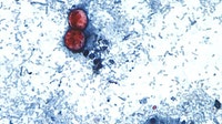 Cyclosporiasis: Some Arizonans turn to local farms