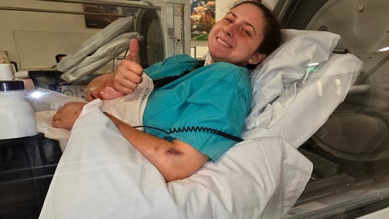 20-year-old hiker warns others after heat stroke at Grand Canyon