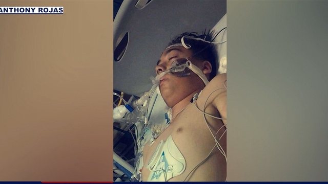Arizona man survives heart attack at 14 thanks to specialized heart pump