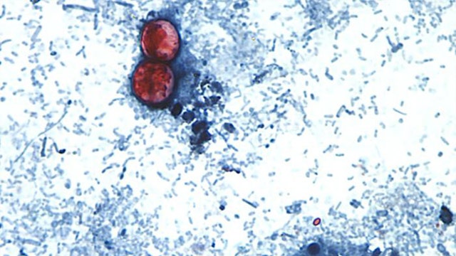 Cyclosporiasis outbreak: Some Arizona consumers turn to local farms