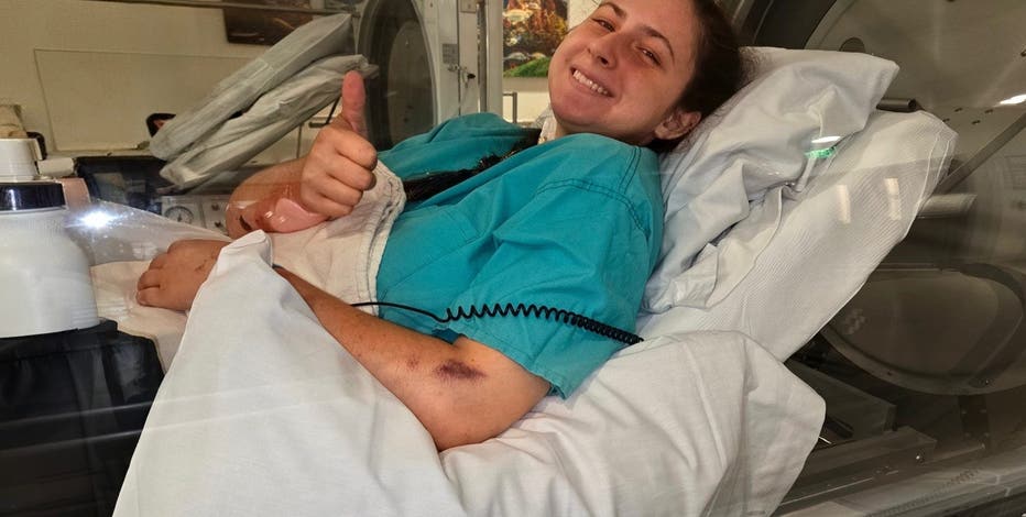 20-year-old hiker warns others after heat stroke at Grand Canyon