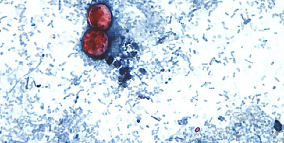 Cyclosporiasis outbreak: Some Arizona consumers turn to local farms