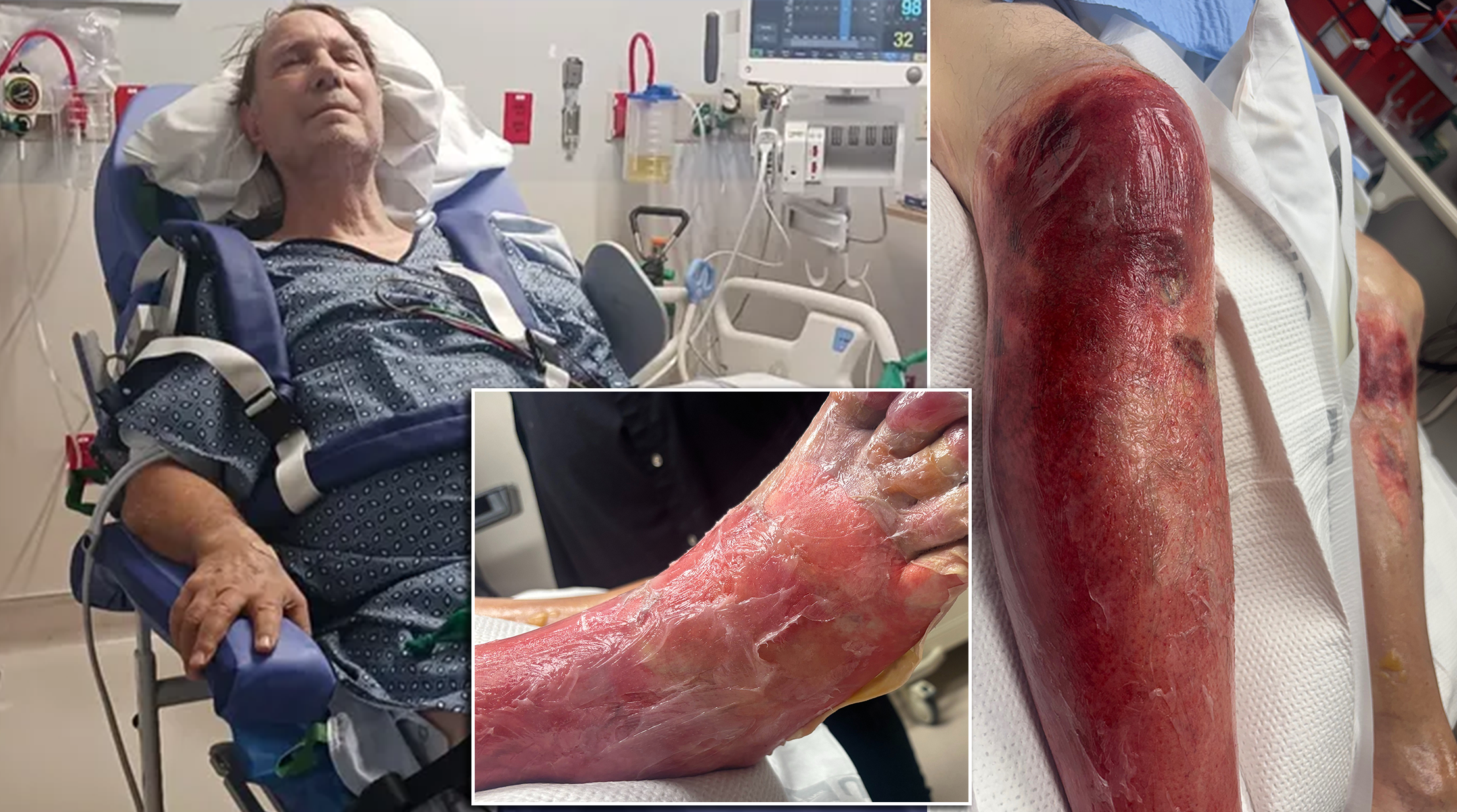 Arizona grandfather to lose leg after falling in 120-degree heat: ‘He’s hurting really bad’