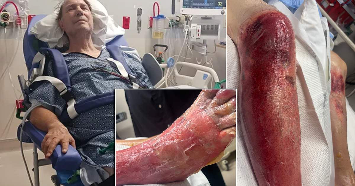 Arizona grandfather to lose leg after falling in 120-degree heat: ‘He’s ...