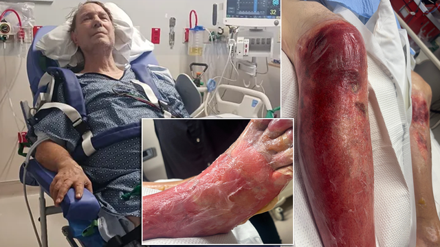 Arizona grandfather to lose leg after falling in 120-degree heat: ‘He’s hurting really bad’