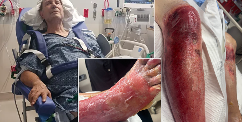 Arizona grandfather to lose leg after falling in 120-degree heat: ‘He’s hurting really bad’