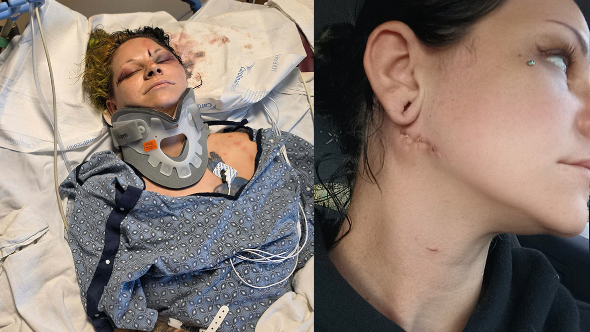 Glendale mother survives brutal attack by fiancé weeks before wedding