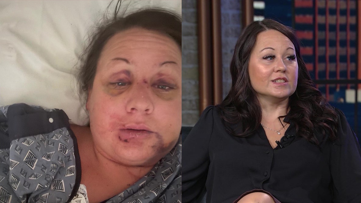 Mesa domestic violence survivor shares story after ex-boyfriend stabbed her 22 times