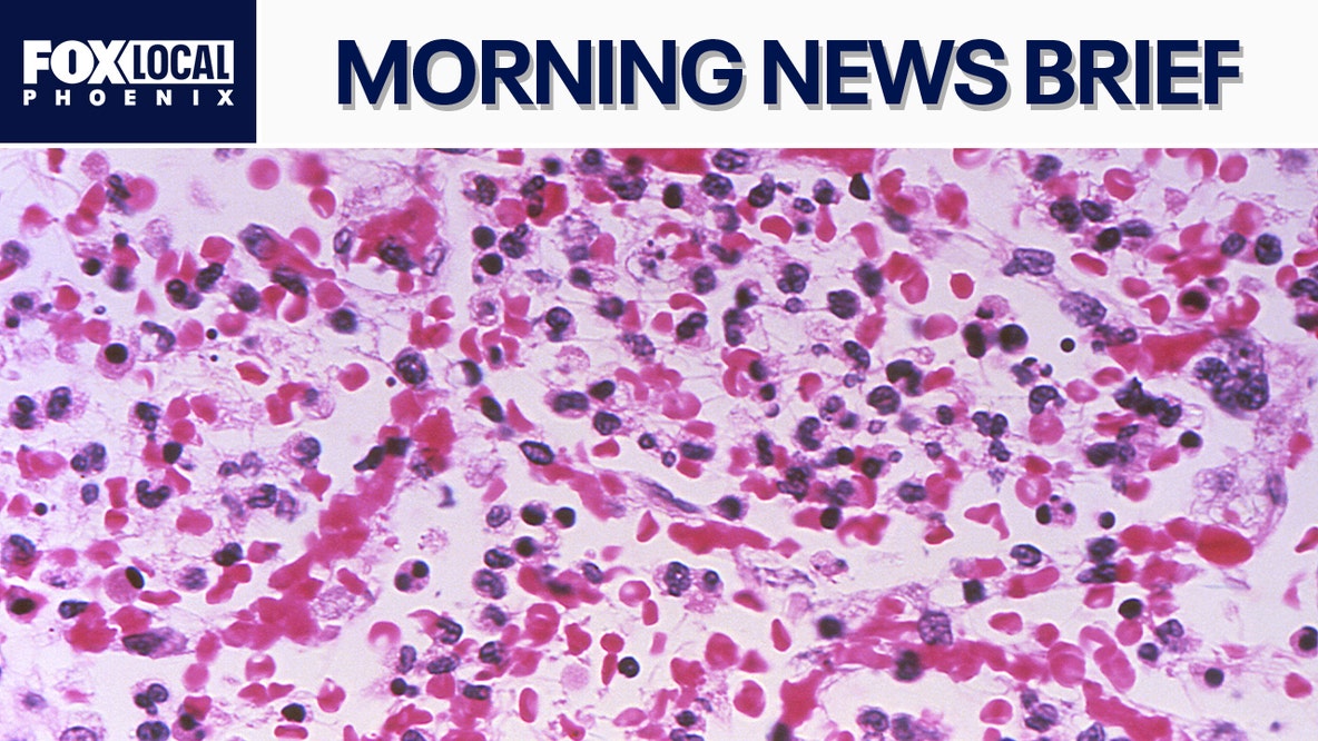 Glendale tenants fight $4,000 rent hikes; Televangelist Jim Bakker dies | Morning News Brief