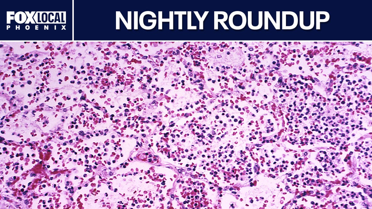 Russian lab tech dies from suspected plague exposure; indictment in Mesa shooting | Nightly Roundup