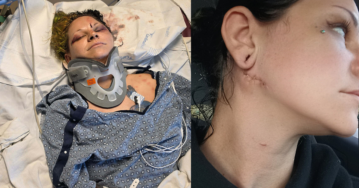 Glendale mother survives brutal attack by fiancé weeks before wedding
