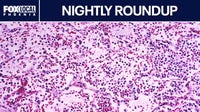 Russian lab tech dies from suspected plague exposure; indictment in Mesa shooting | Nightly Roundup