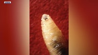 Screwworm case in AZ: Livestock owners on alert