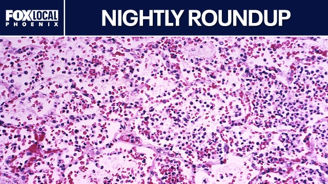 Russian lab tech dies from suspected plague exposure; indictment in Mesa shooting | Nightly Roundup