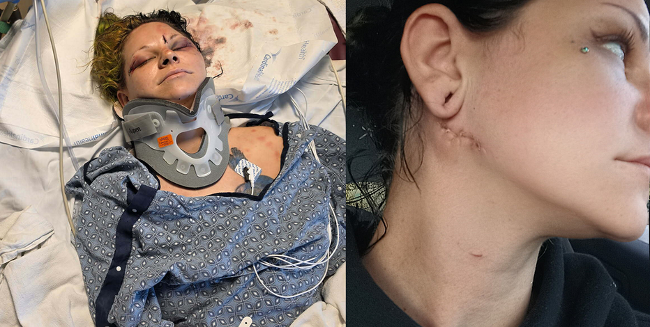 Glendale mother survives brutal attack by fiancé weeks before wedding