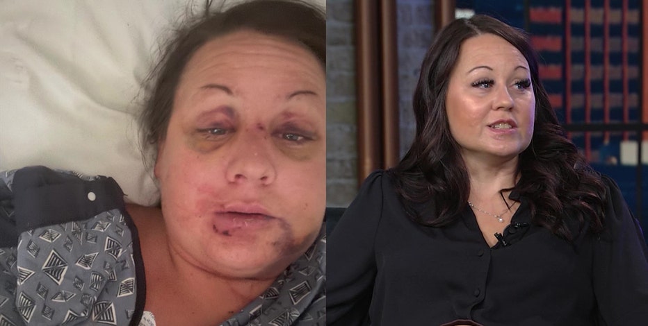 Mesa domestic violence survivor shares story after ex-boyfriend stabbed her 22 times