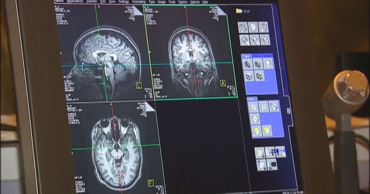 God Shot Injection 'God Shot' may help PTSD sufferers | FOX 13 Tampa Bay