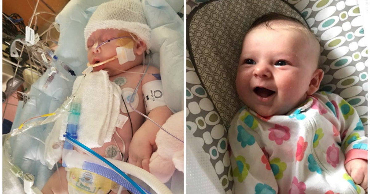 Baby girl hospitalized with brain injury after getting hit on head by ...
