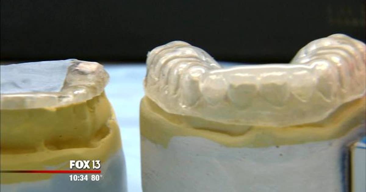 Researchers creating a smart mouth guard | FOX 13 Tampa Bay