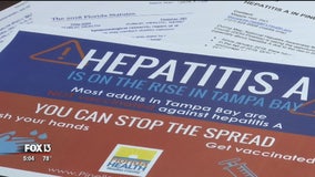 Despite rise in cases, experts say risk of contracting hepatitis A still low