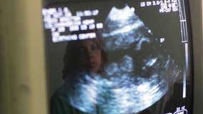 Florida House passes 15-week abortion limit bill