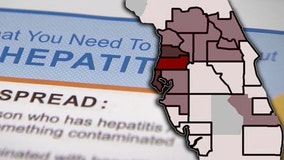Florida's surgeon general declares public health emergency for hepatitis A