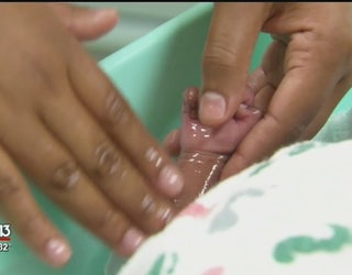 Swaddle Baths Recommended For Premature Babies