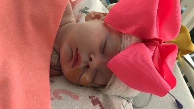 Baby severely injured in softball accident breathing on her own