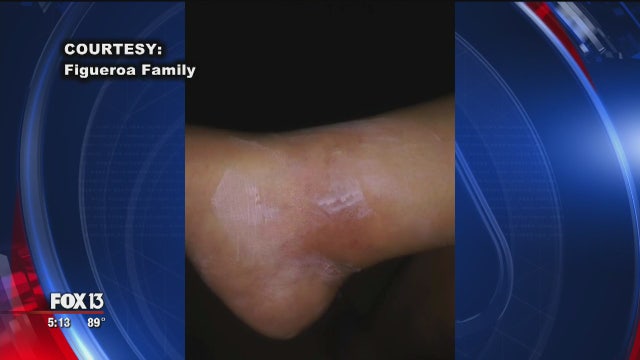 Family swarmed by bees near their Tampa home
