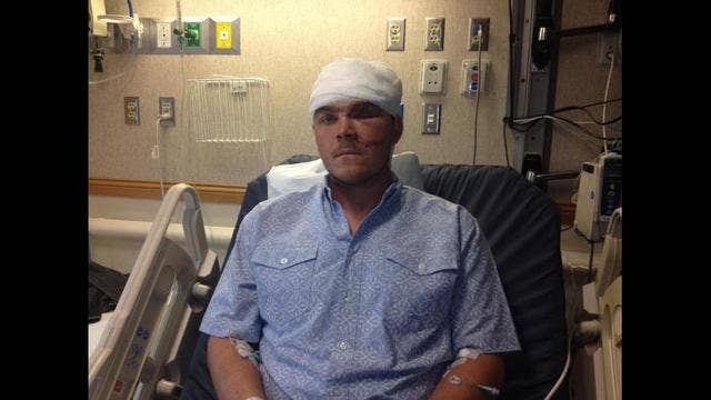 Hunter escapes attack by shoving arm down bear's throat