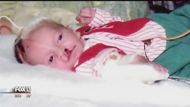 Doctor starts charity to help cleft lip, palate patients