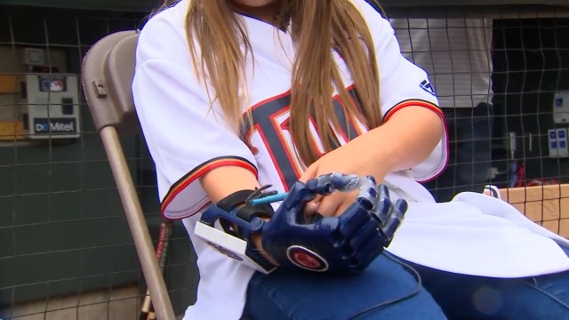 Girl with robotic hand on a mission to throw out first pitch at every MLB stadium
