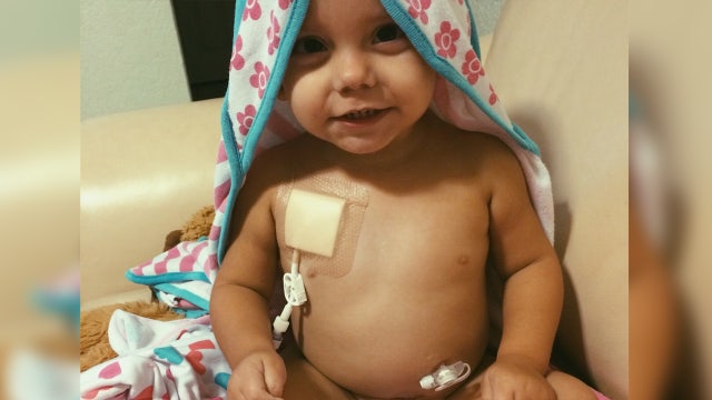 Toddler's family hopes for transplant, generosity