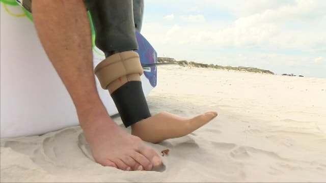 Having one leg is no challenge for surfer who inspires others