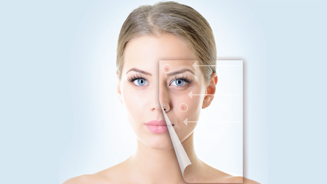 People with acne have more youthful skin