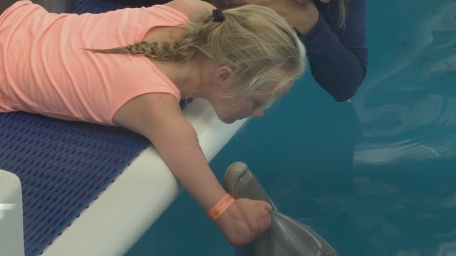 Quadruple amputee meets dolphin that inspired her