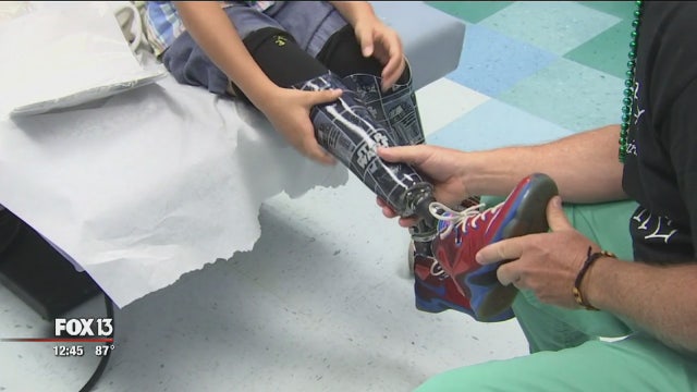 Shriners Hospital personalizes prosthetics for children