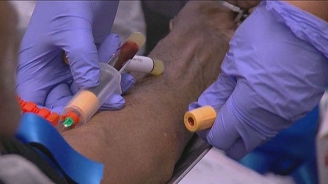 Free HIV/AIDS tests offered Thursday