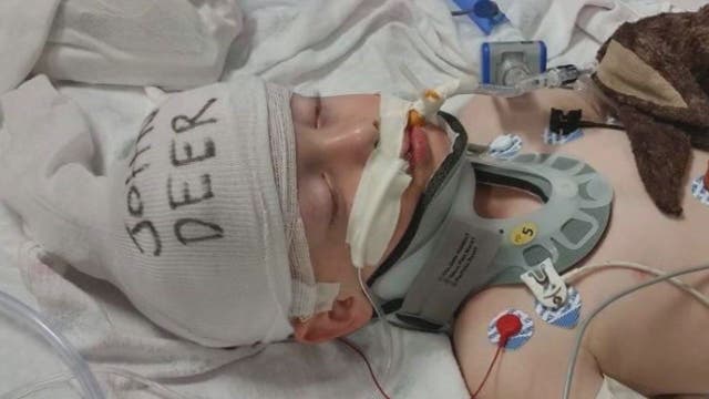 Firefighters rally around boy injured in accident
