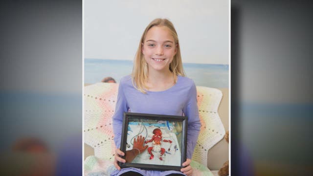 Thriving 10-year-old gymnast is poster child for premature babies