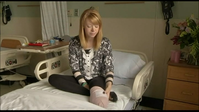 Boston Marathon bombing survivor runs in this year's race with prosthetic leg