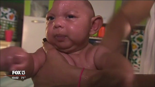 3 cases of Zika in pregnant Florida women reported