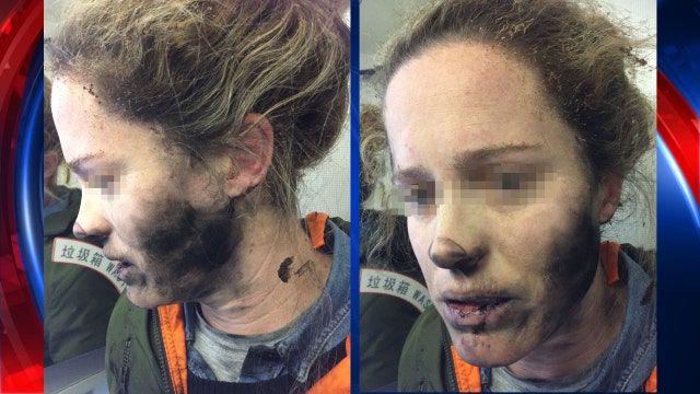 Woman burned after headphones explode on flight to Australia