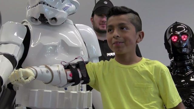 Boy gets prosthetic 'Stormtrooper' arm from non-profit group