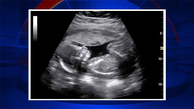 Woman's Facebook PSA: Stop asking people about baby plans