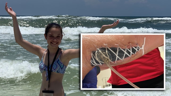 Destin Beach Babes - Mom says girl developed deadly 'flesh-eating' bacteria while ...