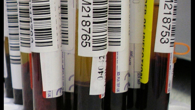 bbeb3a7f-Blood_test_1450471416813_646717_ver1.0_1489782034240.jpg